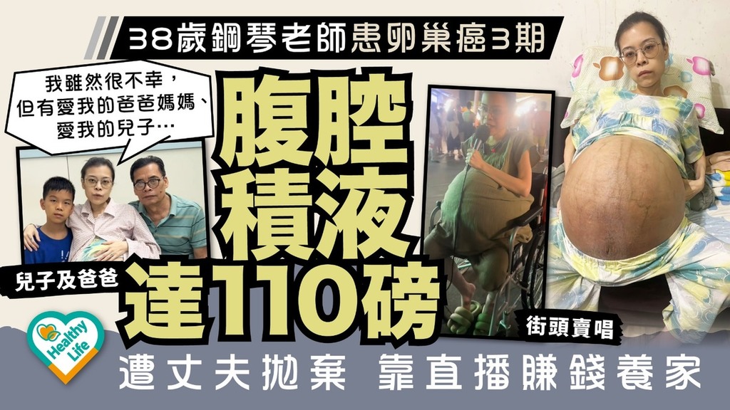 卵巢癌｜38歲鋼琴老師患卵巢癌3期腹腔積液達110磅 遭丈夫拋棄靠直播賺錢養家