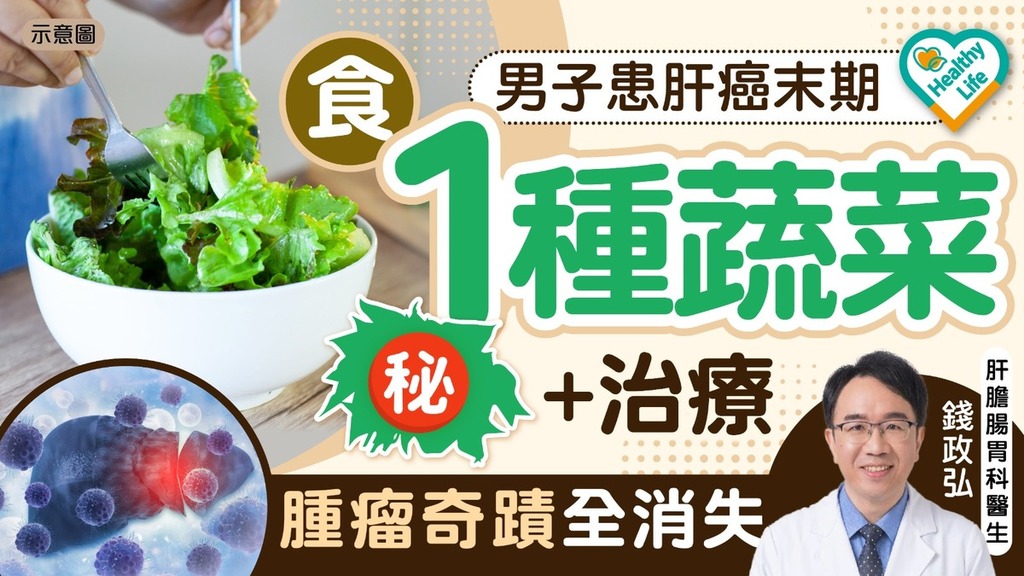 抗癌食物｜肝癌男子食1種蔬菜搭配治療腫瘤全消失 醫生解構成分：有抗癌潛力