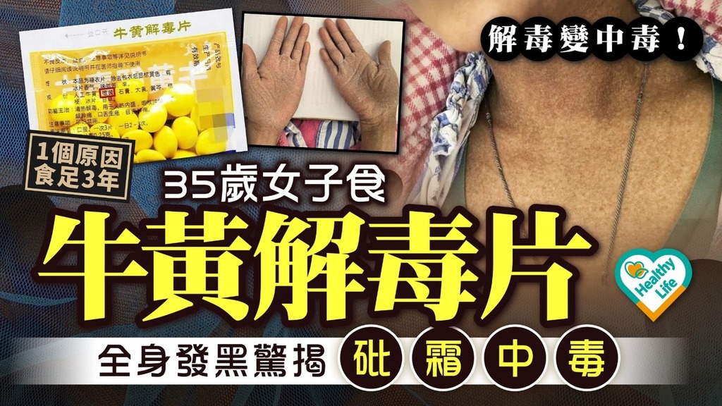 砒霜中毒｜35歲媽食牛黃解毒片3年 全身發黑求醫驚揭砒霜中毒【附食安中心建議】