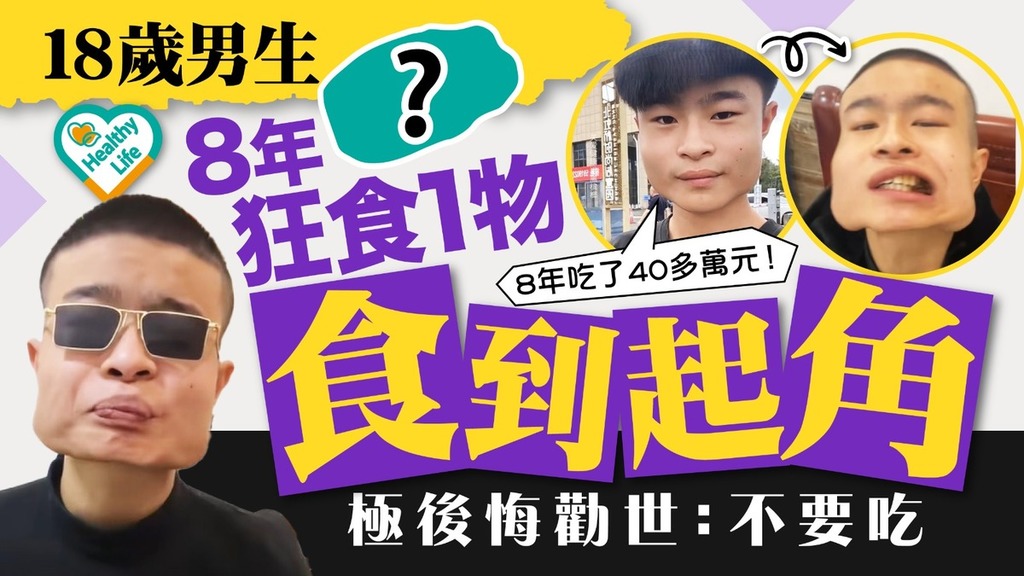 口腔癌｜18歲男生8年狂吃1種食物 零P圖瓜子面食到起角勸世：不要吃【附醫生拆解致癌成因】