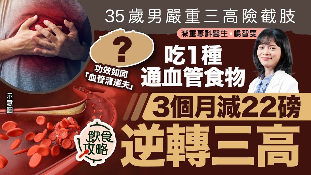 逆轉三高｜35歲男嚴重三高險截肢 吃1種通血管食物3個月減22磅逆轉三高【附降三高飲食+生活建議一覽】