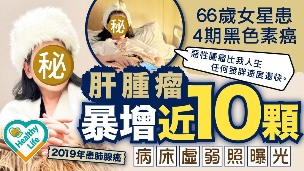 抗癌勇士｜66歲女星患4期黑色素癌 肝腫瘤暴增近10顆病床虛弱照曝光 