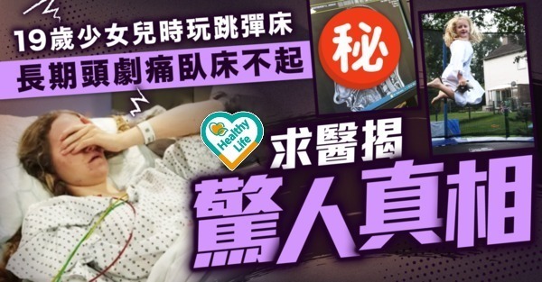 罕見病｜彈跳床後長期頭痛  19歲女多年求醫無果  驚揭1原因慘致「大腦跌出」