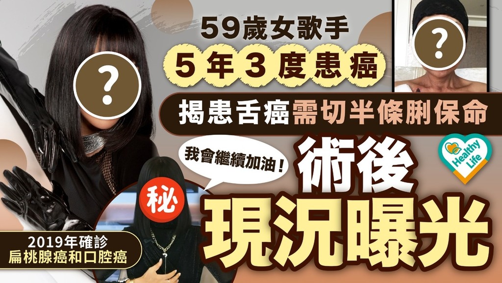 抗癌勇士｜59歲女歌手3度患癌切半條脷保命 術後現況曝光