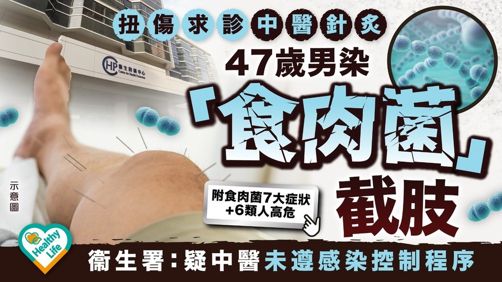 甲類鏈球菌｜47歲男扭傷求診中醫針炙染「食肉菌」截肢 衞生署：疑中醫未遵感染控制程序