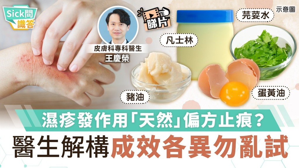 Sick問識答｜濕疹發作用「天然」偏方止痕？ 醫生解構成效各異勿亂試