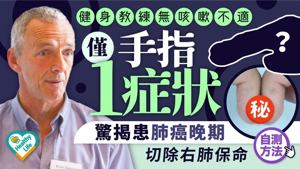 癌症殺手︱健身教練無咳嗽不適 僅手指1症狀驚揭患肺癌晚期 切除右肺保命