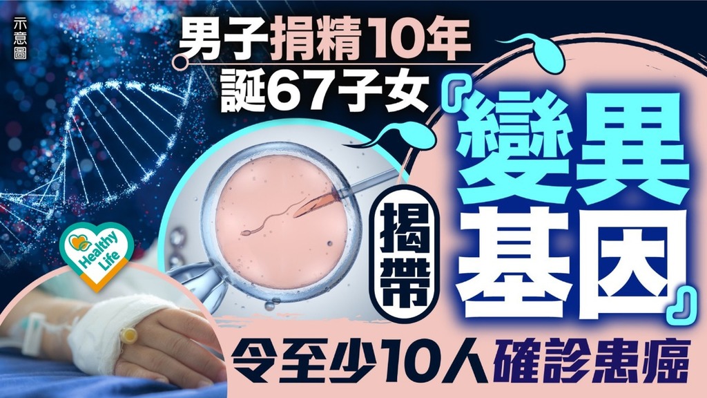 精子捐贈｜捐精10年誕67子 歐洲男子揭帶「變異基因」 至少10人確診患癌