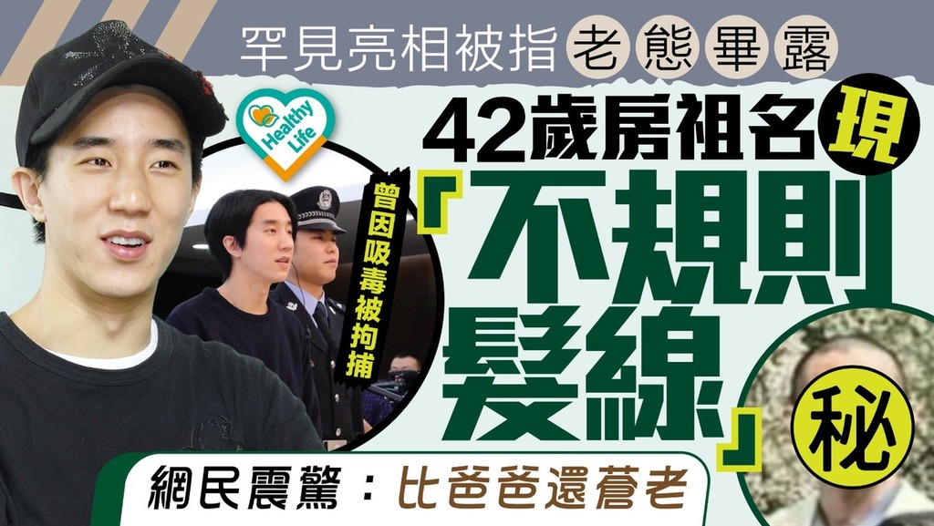 驚人變化｜42歲房祖名罕見亮相被指老態畢露 現「不規則髮線」網民震驚：比成龍還蒼老