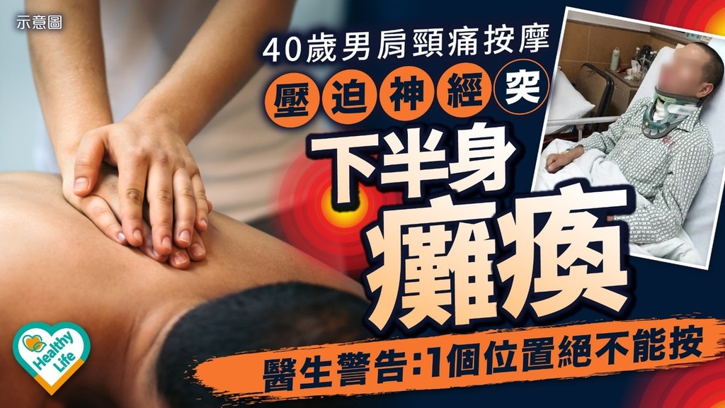 按摩風險｜40歲男肩頸痛按摩 壓迫神經突下半身癱瘓 醫生警告：1個位置絕不能按