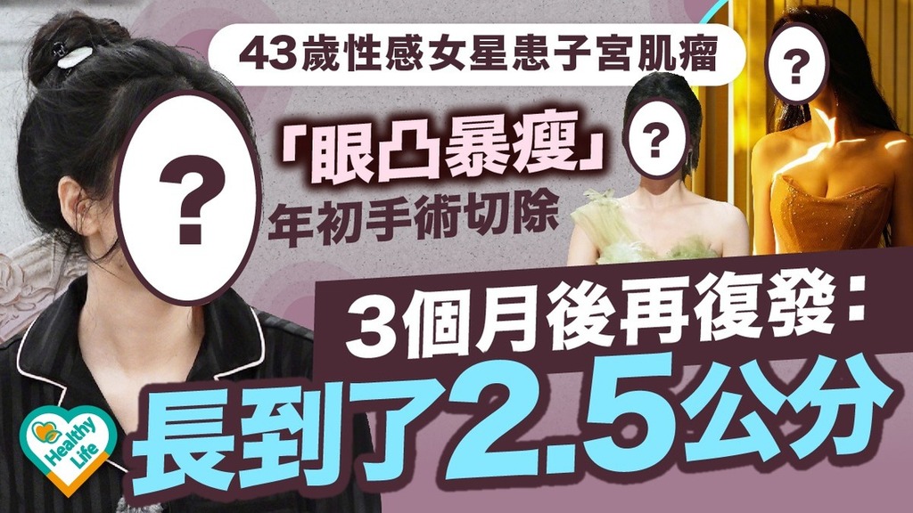 子宮肌瘤︱43歲性感女星患子宮肌瘤「眼凸暴瘦」 年初手術3個月後再復發：長到了2.5公分