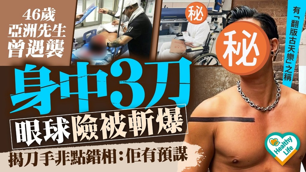 明星健康｜46歲亞洲先生曾遇襲眼球險被斬爆 揭刀手非點錯相：佢有預謀