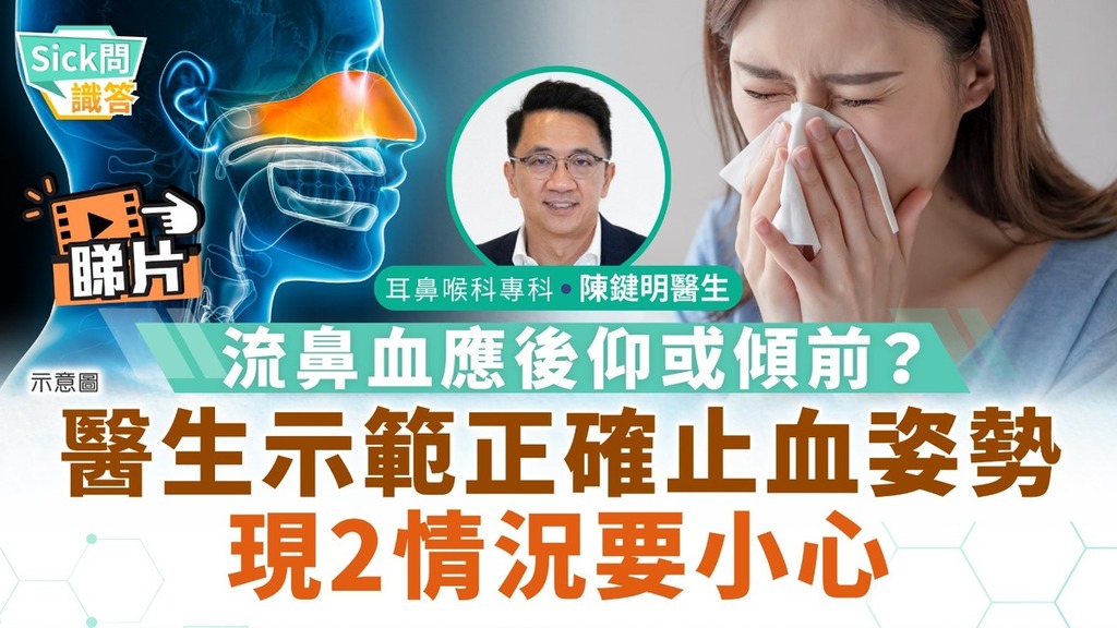Sick問識答｜流鼻血應後仰或傾前？ 醫生示範正確止血姿勢 現2情況要小心