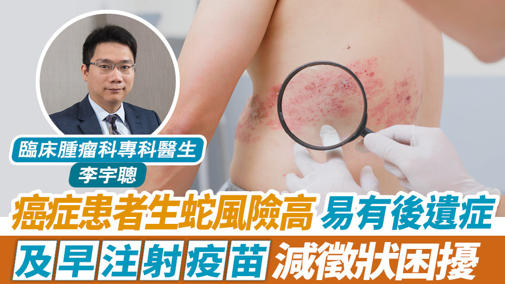 癌症患者生蛇風險高 易有後遺症 及早注射疫苗 減徵狀困擾