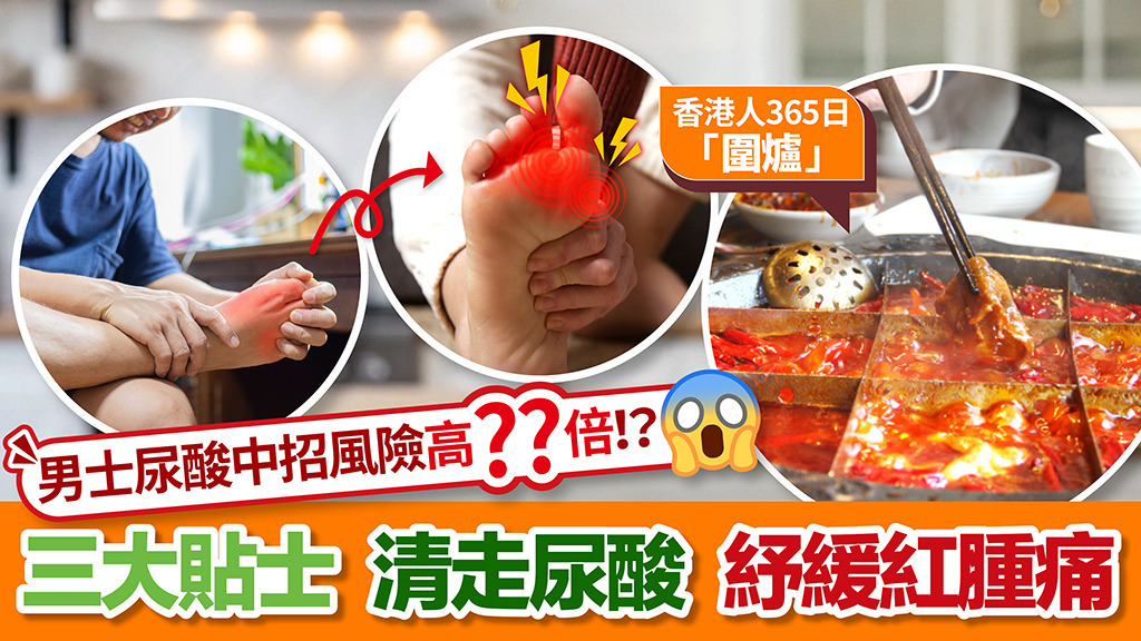 香港人365日圍爐 男士尿酸中招風險高近60%！？三大貼士 清走尿酸 紓緩紅腫痛