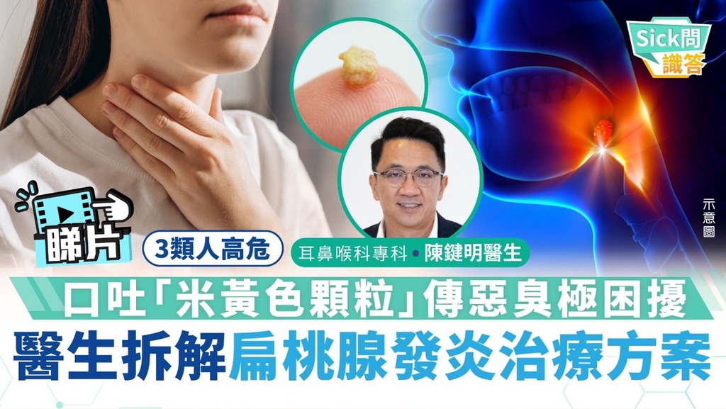 Sick問識答｜口吐「米黃色顆粒」傳惡臭極困擾 醫生拆解扁桃腺發炎治療方案