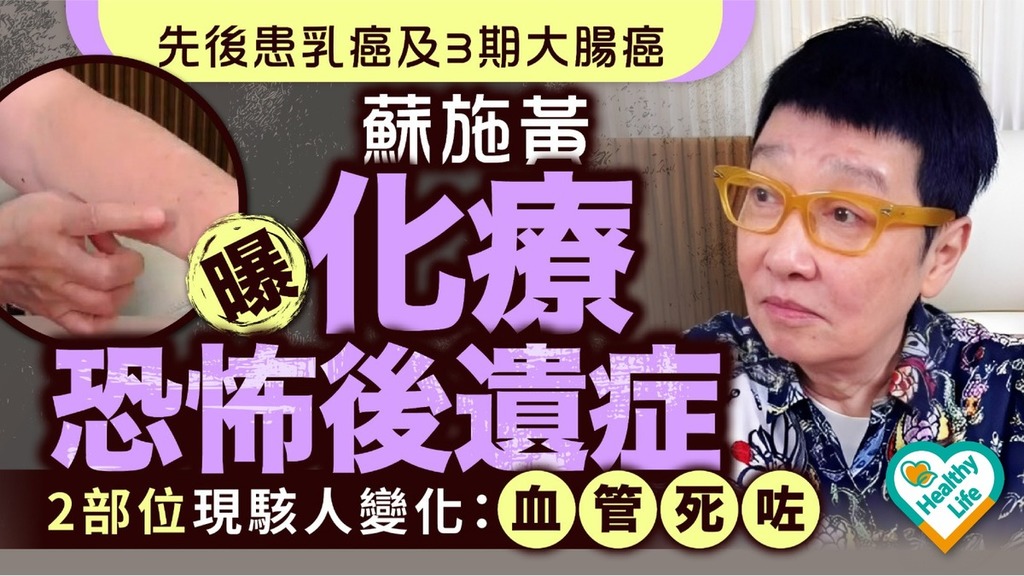 名人健康丨先後患乳癌及3期大腸癌 蘇施黃曝化療恐怖後遺症 2部位現駭人變化