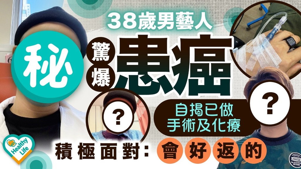 名人健康｜38歲男藝人驚爆患癌 自揭已做手術及化療積極面對：會好返的