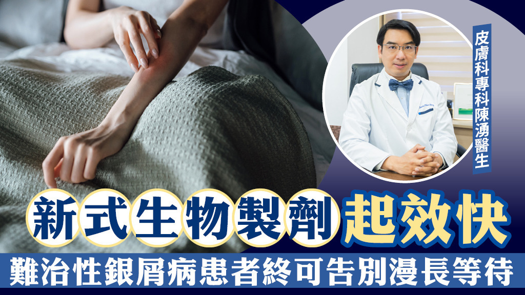 新式生物製劑起效快 難治性銀屑病患者終可告別漫長等待