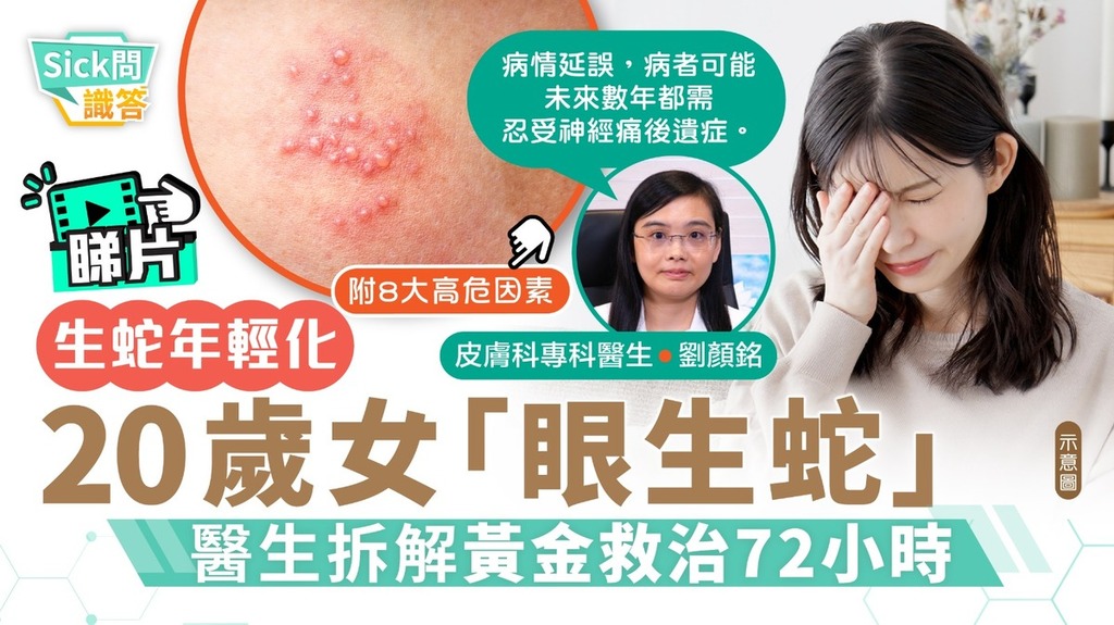 Sick問識答｜生蛇年輕化 20歲女「眼生蛇」 醫生拆解黃金救治72小時
