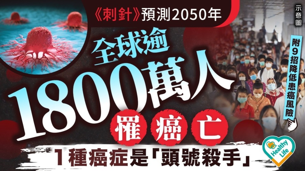 癌症殺手｜《刺針》預測2050年全球逾1800萬人罹癌亡 1種癌症是「頭號殺手」