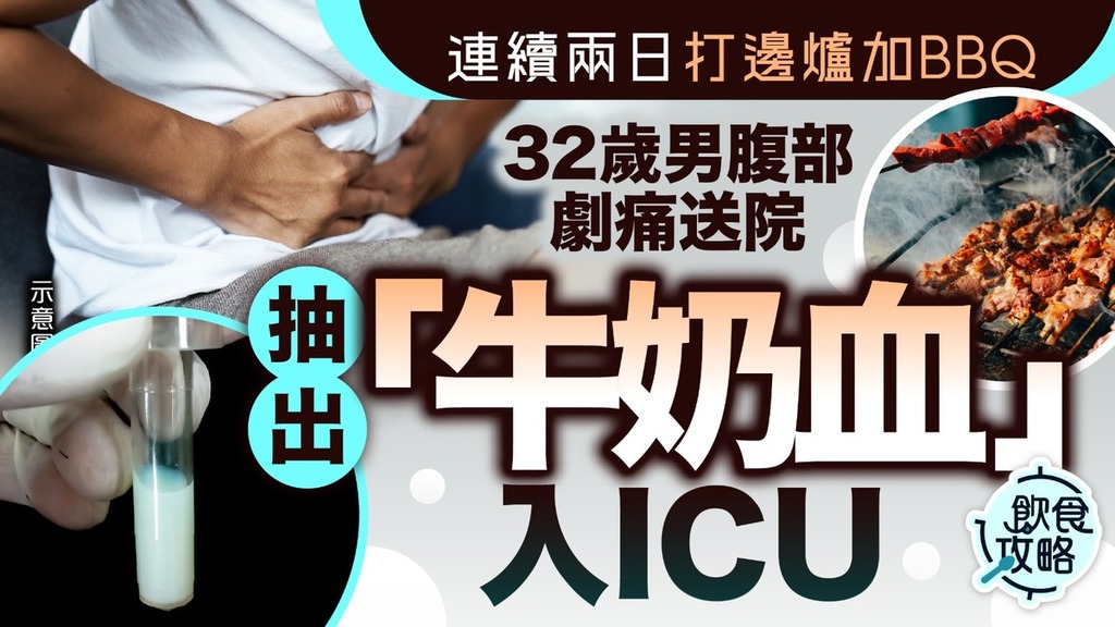 飲食危機丨連續兩日打邊爐加BBQ 32歲男腹部劇痛送院抽出「牛奶血」入ICU