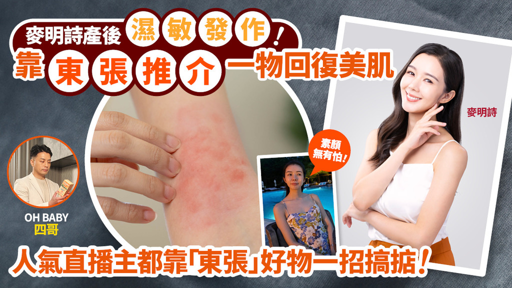 自小「濕敏底」 麥明詩靠一招逆轉濕敏危機