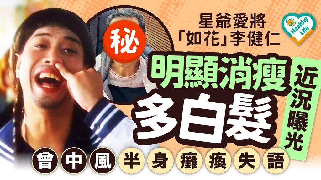明星近況｜星爺愛將「如花」李健仁 明顯消瘦多白髮近況曝光 曾中風半身癱瘓失語
