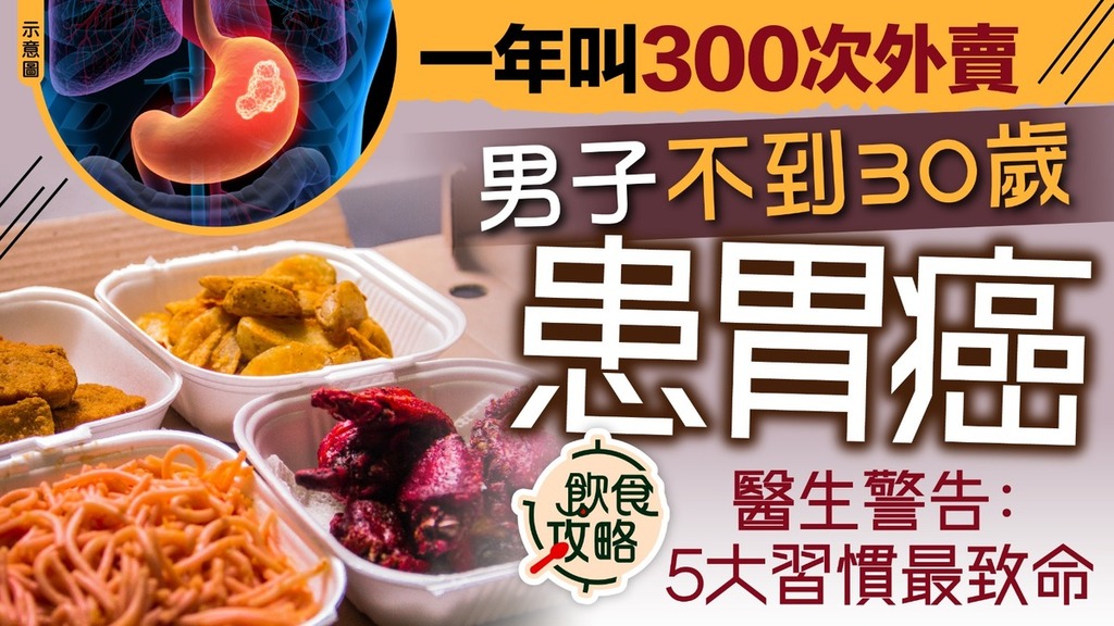 胃癌｜29歲男1年叫外賣300次確診胃癌 醫生警告：5大習慣增致癌風險