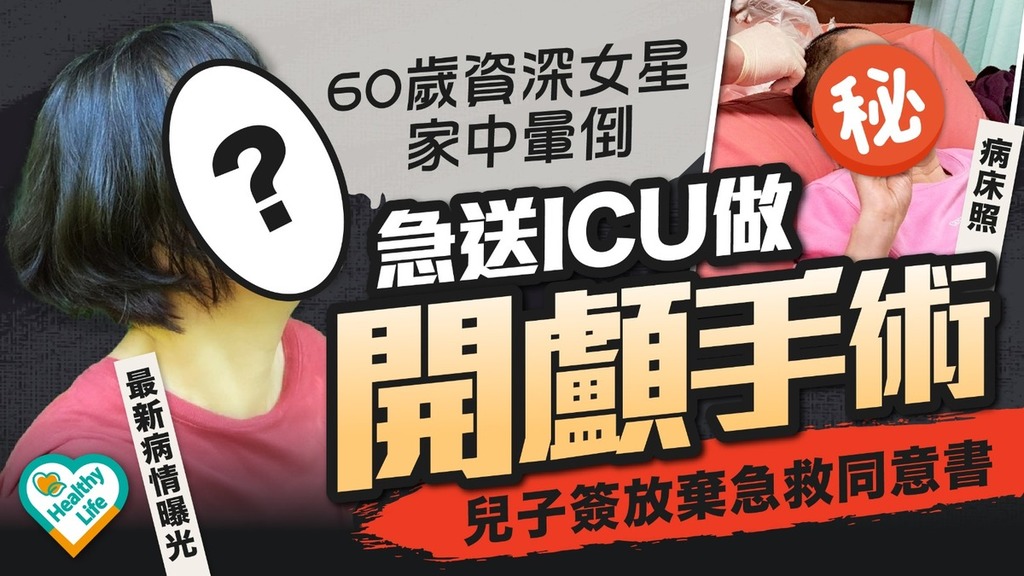明星健康｜60歲女星家中暈倒急送ICU做開顱手術 兒子簽放棄急救同意書現狀曝光