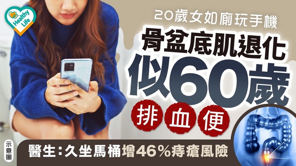 痔瘡危機︱20歲女如廁玩手機骨盆底肌退化似60歲排血便 醫生：久坐馬桶增46%痔瘡風險