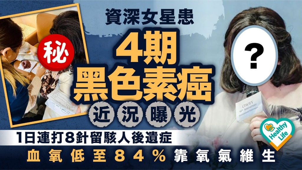 黑色素癌｜資深女星患4期黑色素癌近況曝光 1日連打8針留駭人後遺症血氧低至84%靠氧氣維生