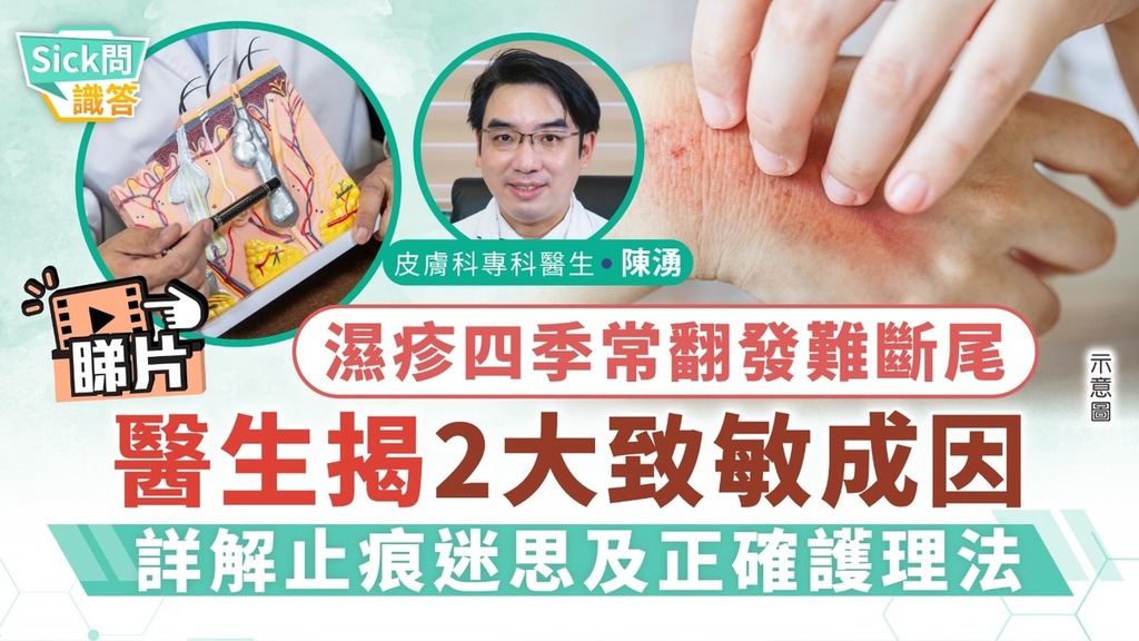 Sick問識答｜濕疹四季常翻發難斷尾 醫生詳解2大致敏成因及止痕迷思