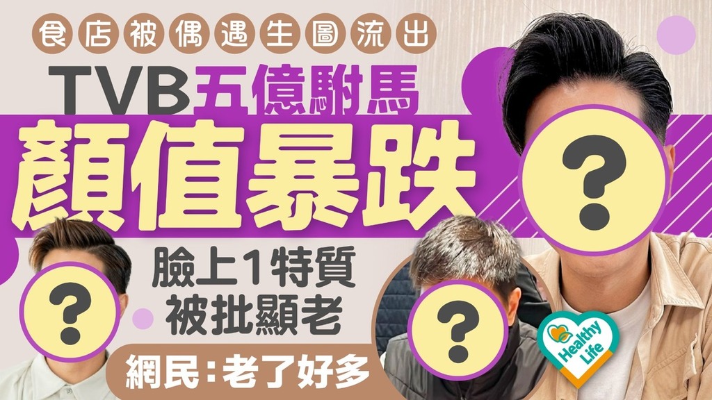男神崩壞丨TVB五億駙馬食店被偶遇生圖流出 顏值暴跌臉上1特質被批顯老