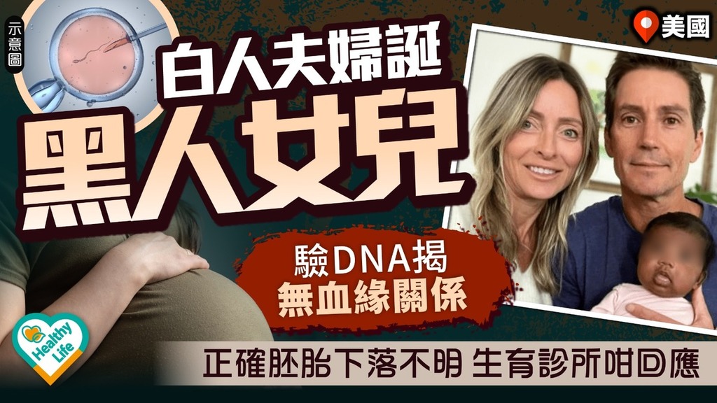 人工受孕︱美國白人夫婦誕黑人女兒驗DNA揭無血緣關係 正確胚胎下落不明生育診所咁回應