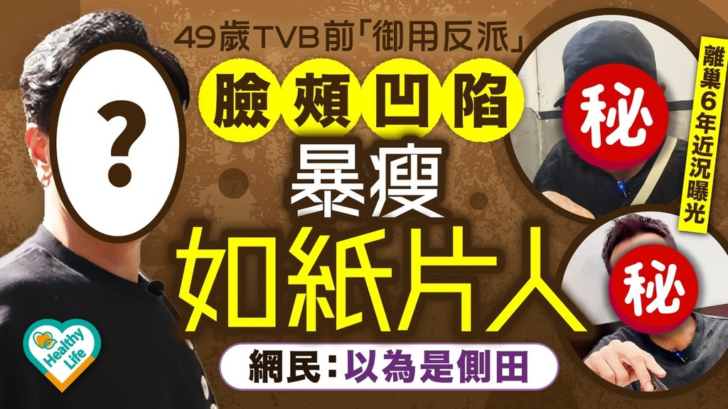 明星健康｜49歲TVB前「御用反派」離巢6年近況曝光 臉頰凹陷暴瘦如紙片人 網民：以為是側田