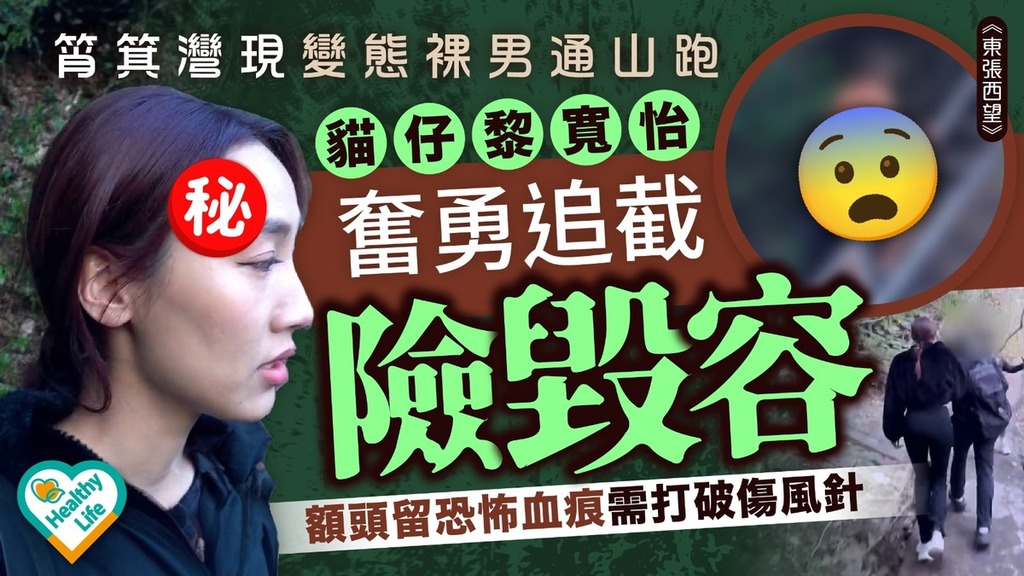 東張西望︱筲箕灣現變態裸男通山跑 「貓仔」黎寬怡奮勇追截險毀容 額頭留恐怖血痕需打破傷風針