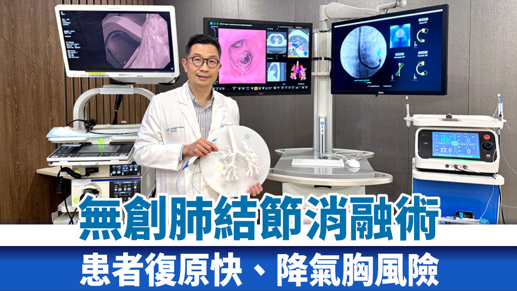 無創肺結節消融術 患者復原快、降氣胸風險