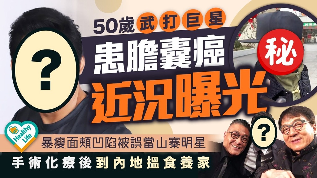 明星健康｜50歲武打巨星患膽囊癌近況曝光 暴瘦面頰凹陷被誤當山寨明星 手術化療後到內地搵食養家