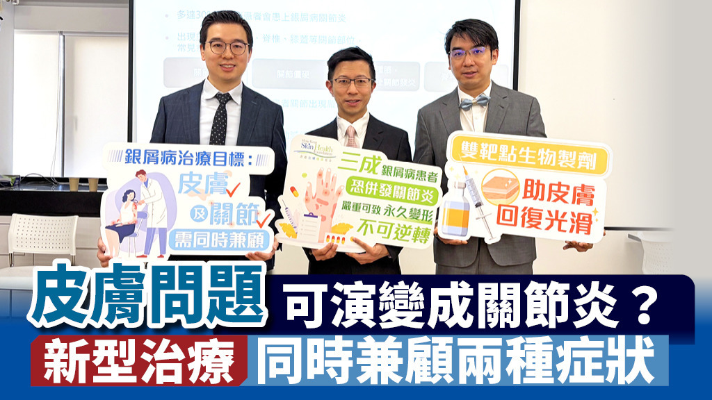 皮膚問題可演變成關節炎？ 新型治療同時兼顧兩種症狀