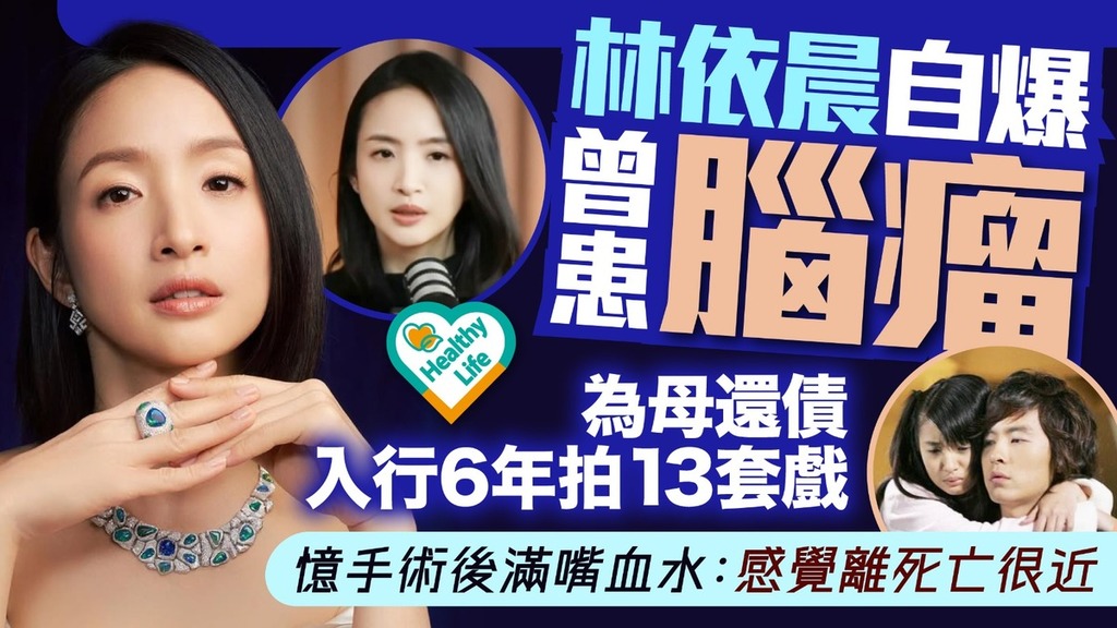 明星健康｜林依晨自爆曾患腦瘤 為母還債入行6年拍13套戲 憶手術後滿嘴血水：感覺離死亡很近