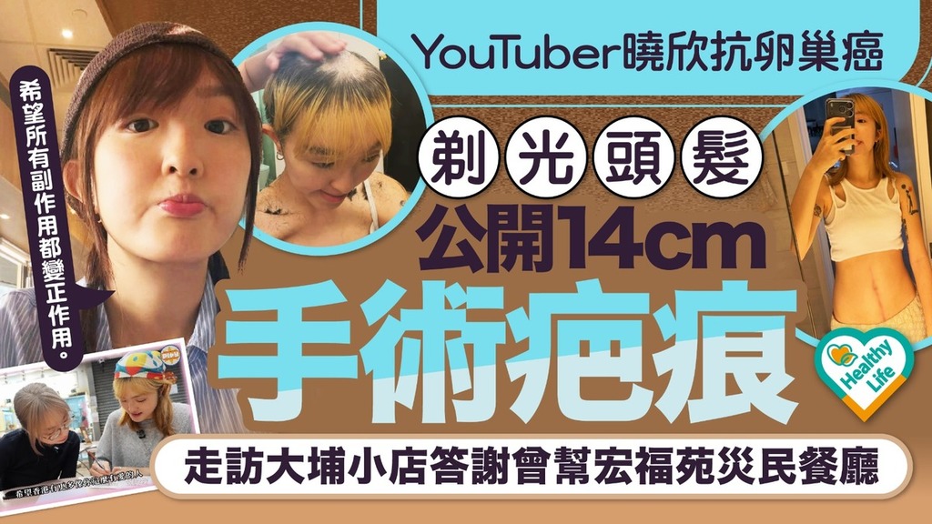 抗癌戰士︱YouTuber曉欣抗卵巢癌剃光頭髮公開14cm手術疤痕 走訪大埔小店答謝曾幫宏福苑災民餐廳