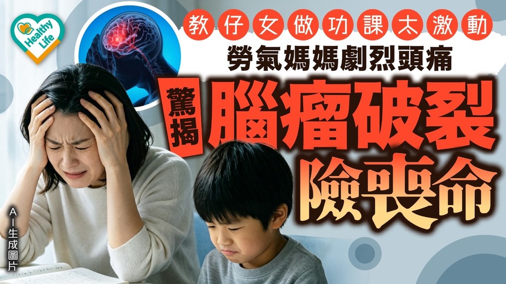 腦瘤破裂｜教仔女做功課太激動 勞氣媽媽劇烈頭痛驚揭腦瘤破裂險喪命