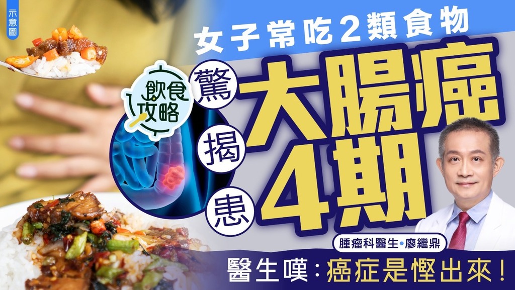 致癌危機｜女子常吃2類食物驚揭患大腸癌4期 醫生嘆：癌症是慳出來！