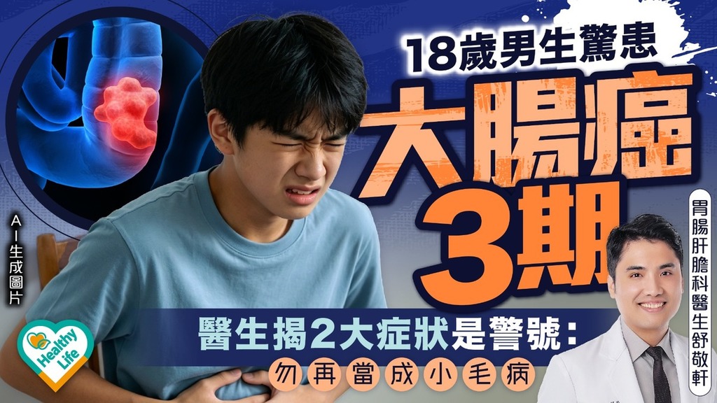 大腸癌年輕化｜18歲男生驚患大腸癌3期 醫生揭2大症狀是警號：勿再當成小毛病