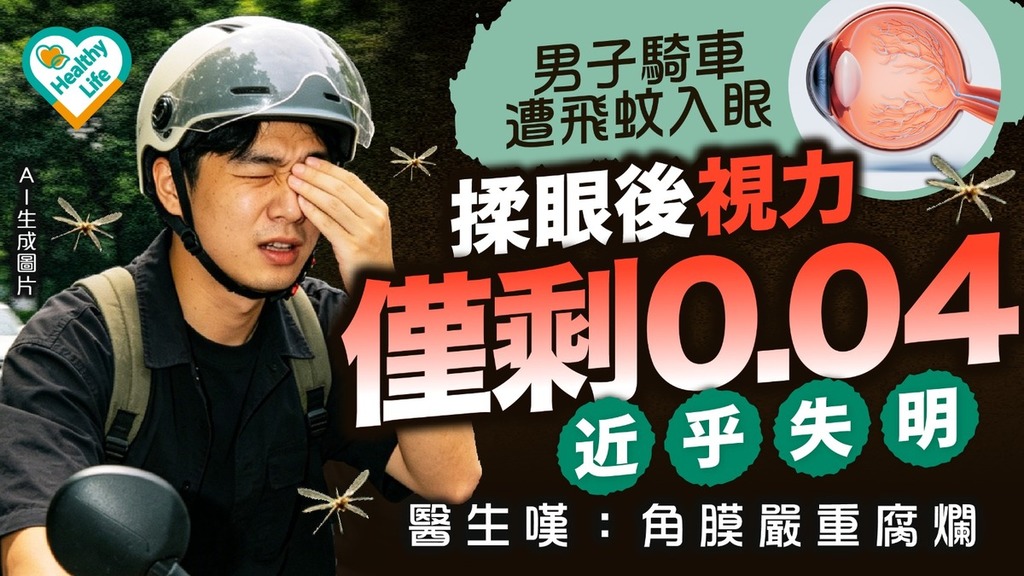 眼睛健康｜男子騎車遭飛蚊入眼 揉眼後視力僅剩0.04近乎失明 醫生嘆：角膜嚴重腐爛
