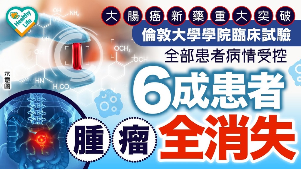 大腸癌｜大腸癌新藥重大突破！ 倫敦大學學院臨床試驗：全部患者病情受控 6成患者腫瘤全消失