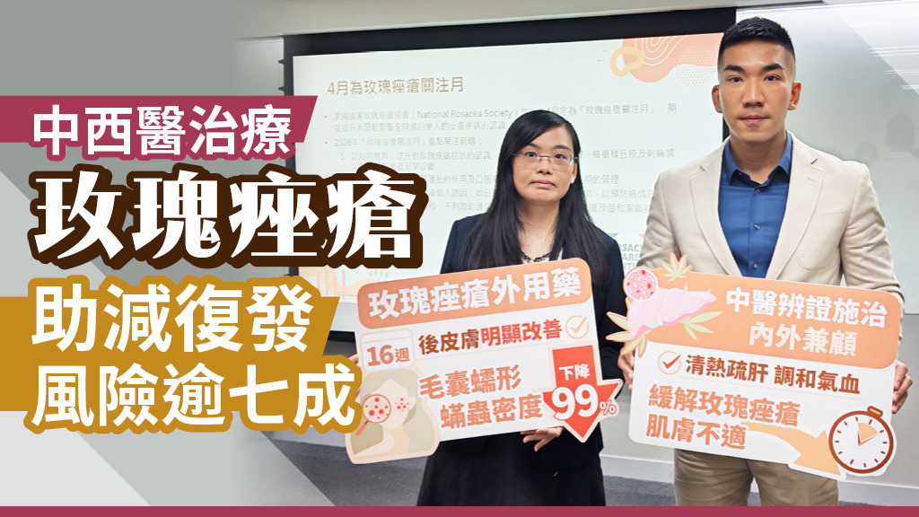 中西醫治療玫瑰痤瘡 助減復發風險逾七成