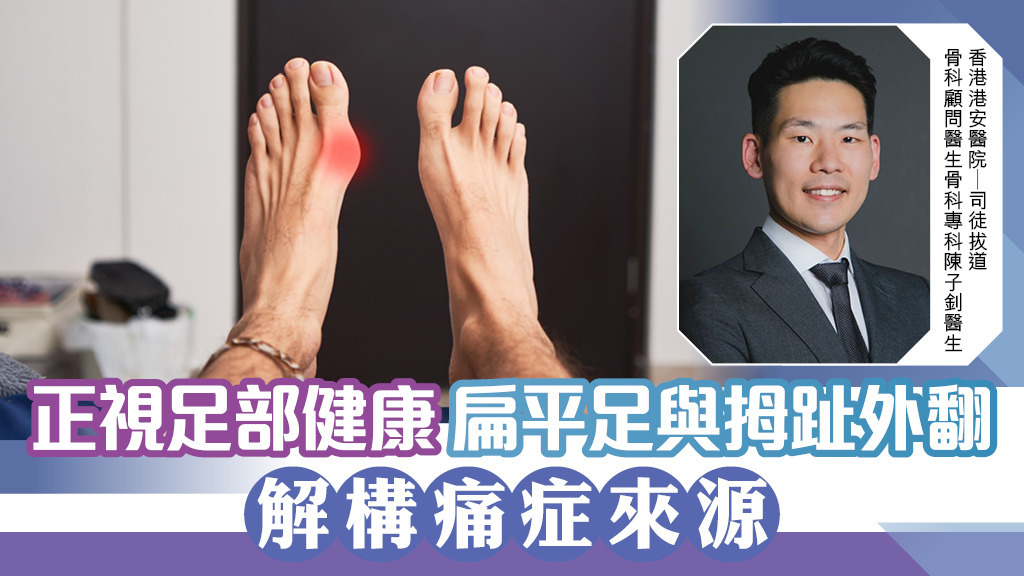 正視足部健康 扁平足與拇趾外翻 解構痛症來源