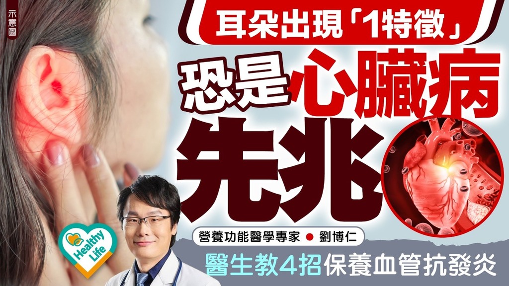 心臟健康｜耳朵出現「1特徵」恐是心臟病先兆 醫生教4招保養血管抗發炎